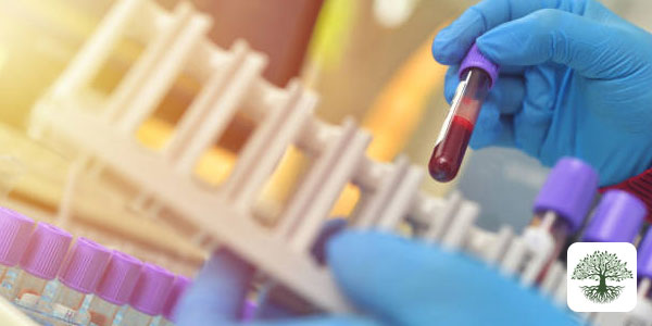 Anemia and Iron Deficiency: Functional Medicine Approach to Hematologic Diseases